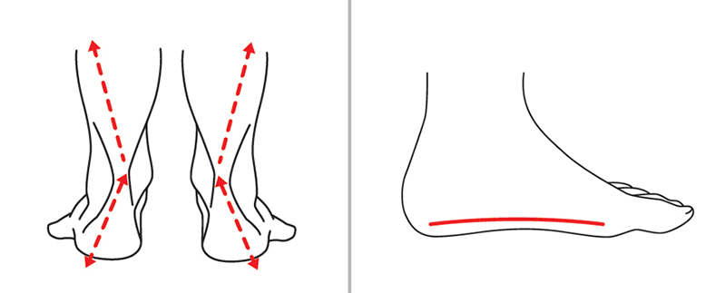 1. Pronação e pé plano.