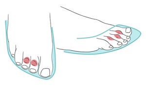 Imagem ilustrativa da fricção entre os dedos e o calçado.