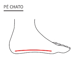 Ilustração do pé Chato