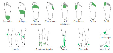 Imagem ilustrativa das áreas de dor nos pés, tornozelos e joelhos.