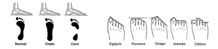 Imagem ilustrativa com os diferentes tipos de pés.