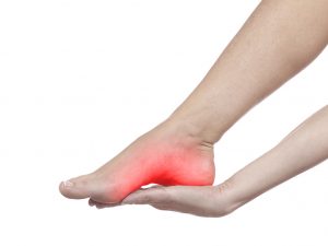 Pé com a região da sola atingida por fascite plantar