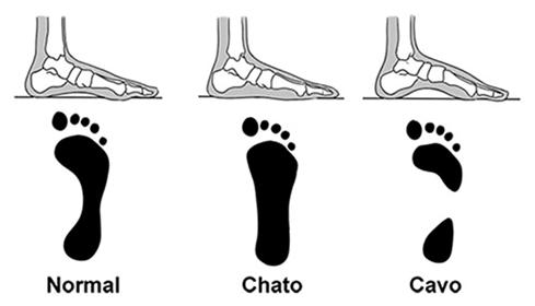 Tipos de pés