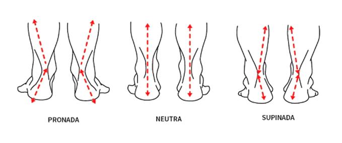 tipos de pisada pronada supinada e neutra