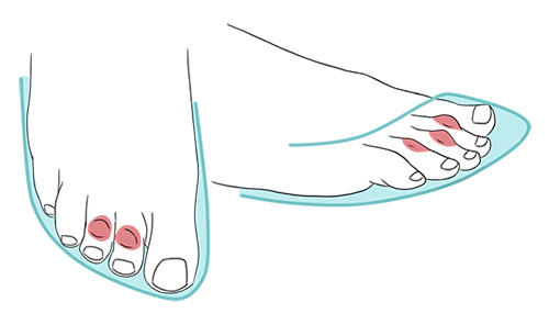 Ilustração de calçado apertado