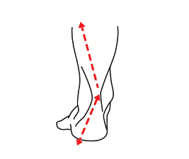 Ilustração das estruturas dos pés e pernas na pisada pronada
