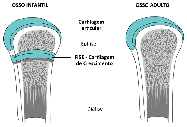 Imagem ilustrativa mostrando a formação do osso e da cartilagem de crescimento