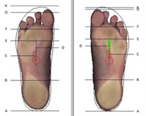 Diferença dos pés