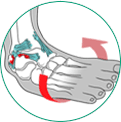 icone ilustrativo para entorse de tornozelo