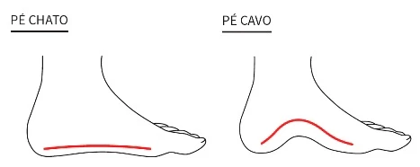 Tipos de pé esporão