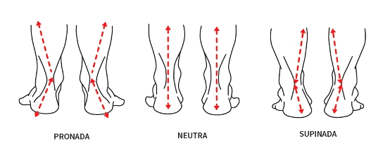 tipos de pisada