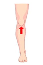 newhome_dores_joelho-ligamento Ilustração de perna em vista frontal com seta vermelha indicando dor no ligamento da frente do joelho